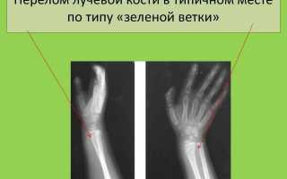 Перелом по типу зеленой ветки: специфика травмы