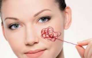 Лечение купероза на лице: наиболее эффективные способы