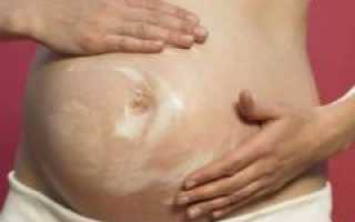 Какой выбрать крем от растяжек после беременности