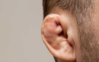Перелом уха: особенности повреждения ушной раковины