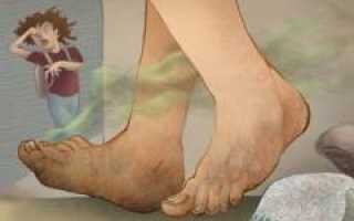 Как избавиться от запаха и потливости ног