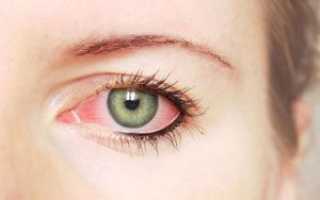Как вызвать покраснение глаз