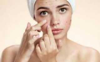 Причины и лечение мелкой сыпи на лице