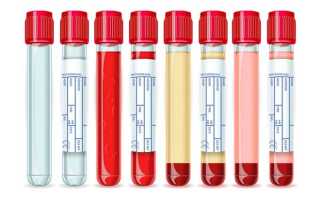 MCH в анализе крови