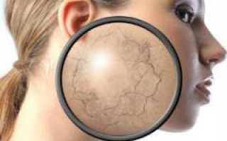 Причины шелушения и зуда кожи