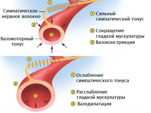 Спазм сосудов сетчатки