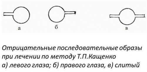 Метод Т.П.Кащенко