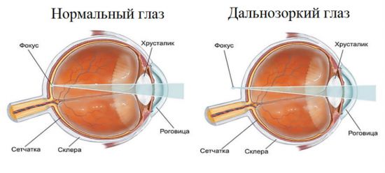 Строение глаза