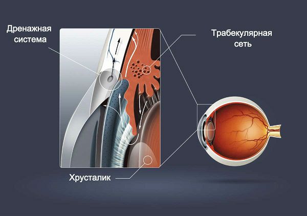 Операция при глаукоме