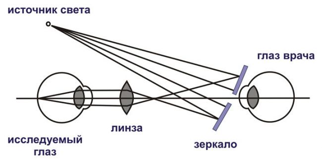 Схема непрямой офтальмоскопии