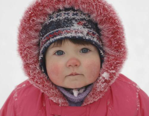 Аллергия на мороз у ребенка