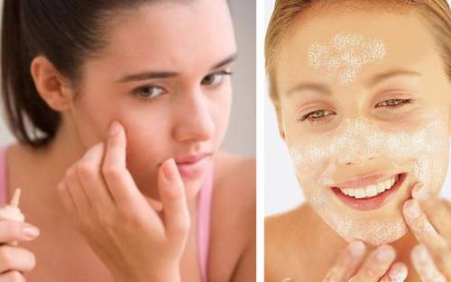 Лечение кожи лица масками
