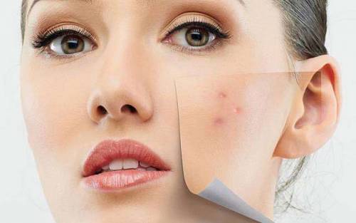 Устранение дефектов кожи косметическим процедурами