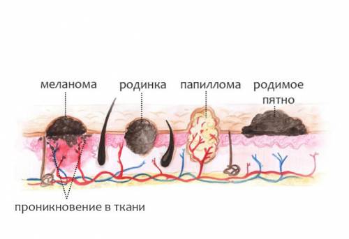 Разные типы образований на коже
