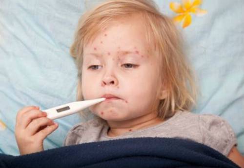 Сыпь и температура у ребенка